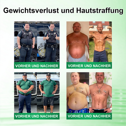 🇩🇪 𝐎𝐟𝐟𝐢𝐜𝐢𝐚𝐥𝐞𝐫 𝐃𝐞𝐮𝐭𝐬𝐜𝐡𝐥𝐚𝐧𝐝-𝐒𝐡𝐨𝐩 | 🧑‍⚕️🩺 𝐃𝐑.𝐇𝐎𝐍𝐎𝐑® 𝐋𝐲𝐦𝐩𝐡𝐝𝐫𝐚𝐢𝐧𝐚𝐠𝐞 𝐒𝐜𝐡𝐥𝐚𝐧𝐤𝐡𝐞𝐢𝐭𝐬-𝐍𝐚𝐧𝐨-𝐌𝐢𝐤𝐫𝐨𝐧𝐚𝐝𝐞𝐥-𝐏𝐟𝐥𝐚𝐬𝐭𝐞𝐫 — 𝐄𝐢𝐧𝐦𝐚𝐥 𝐭ä𝐠𝐥𝐢𝐜𝐡, 𝐬𝐢𝐜𝐡𝐭𝐛𝐚𝐫𝐞 𝐄𝐫𝐠𝐞𝐛𝐧𝐢𝐬𝐬𝐞 𝐢𝐧 𝟕 𝐓𝐚𝐠𝐞𝐧
